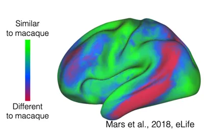 Animal brain versus human brain