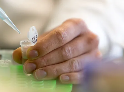 Detailfoto van een microbiologisch onderzoek