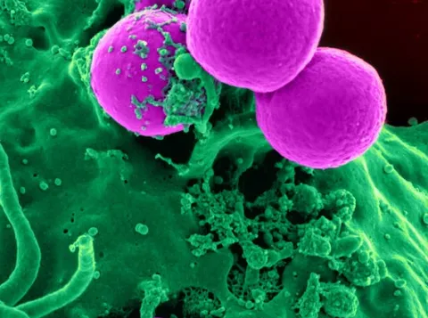 cells 