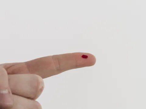 bleeding finger 