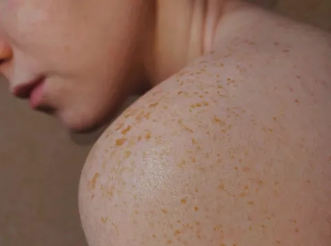 Woman with brown hair