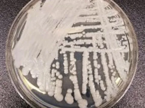 Vijf vragen over de schimmel Candida auris