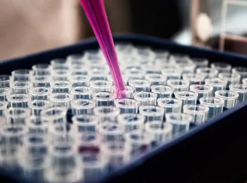 Transfer RNA: a new drug for peripheral neuropathy?