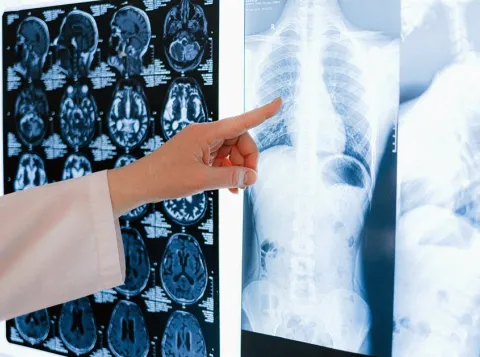 Brain basics: How the brain controls your body so you don’t have to