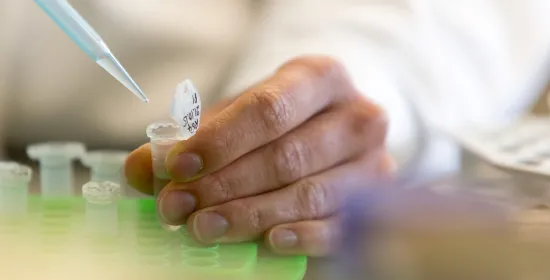 Detailfoto van een microbiologisch onderzoek