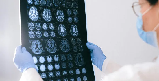 Dokter houdt plaat van hersenen-scan in handen