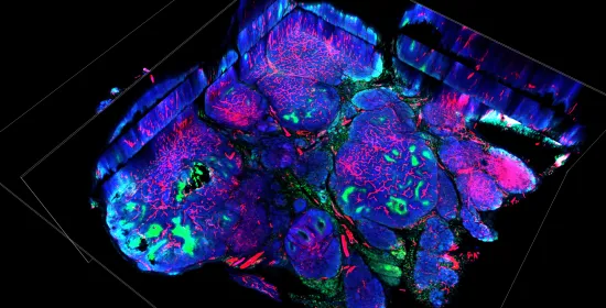 Tackling cancer with radioactive particles