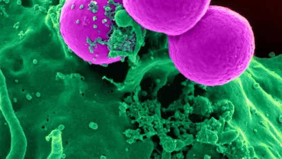 cells 